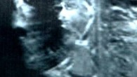 Jezus verschijnt op MRI Jezus verschijnt op MRI - en op de achterkant van een hond